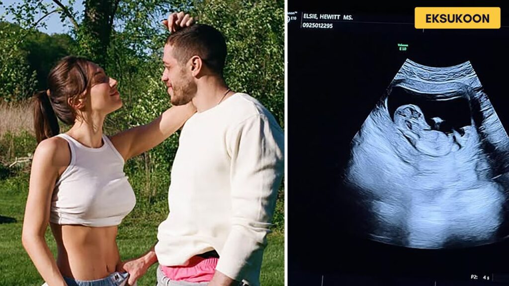 Pete Davidson & Elsie Hewitt Expect First Baby