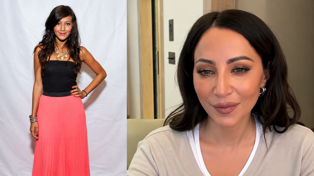 Kay Adams Plastic Surgery
